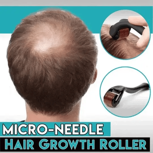 Derma Roller for Hair Growth ( IMPORTED )